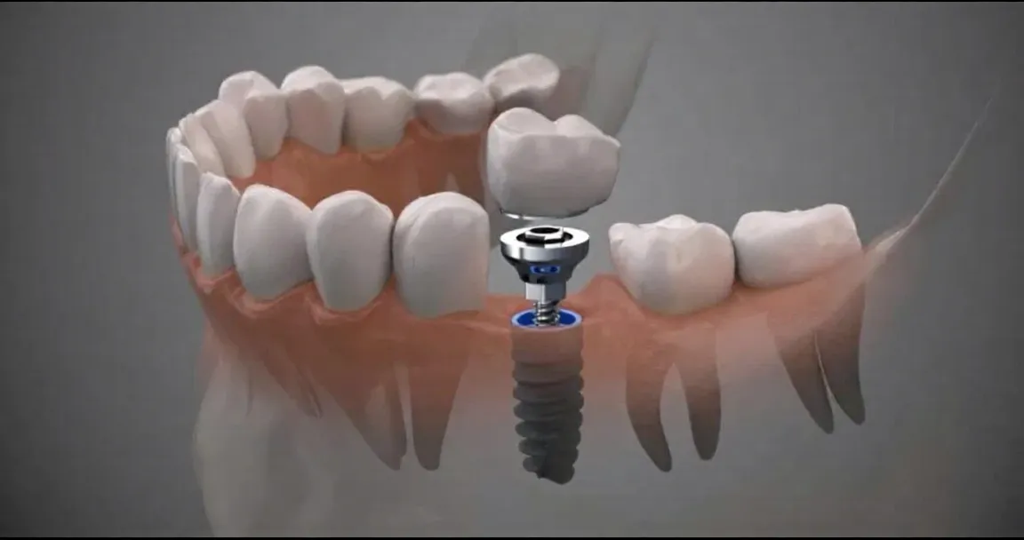 Modern dental technology